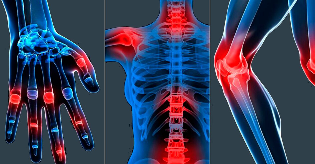 Indicații pentru utilizarea extractului de Boswellia în capsule