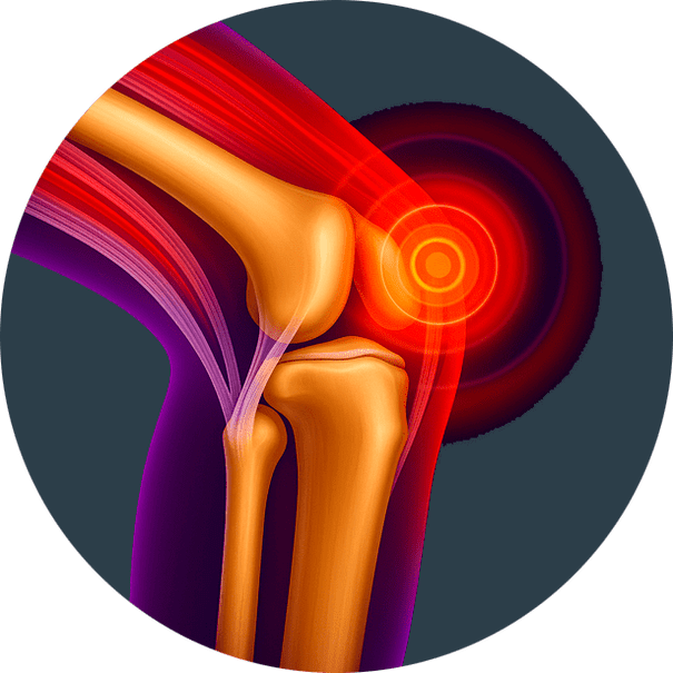 Inflamație articulară