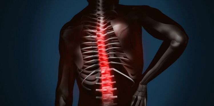 leziuni ale coloanei vertebrale datorate osteocondrozei